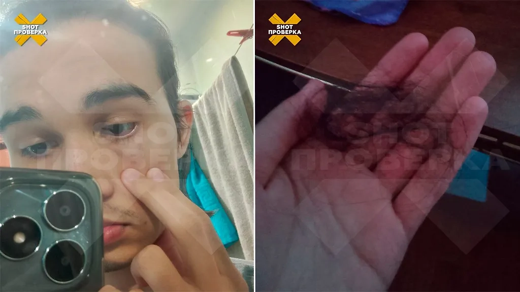 В Уфе сотрудницы "Пятёрочки" вырвали парню клок волос. Фото © Telegram / SHOT ПРОВЕРКА