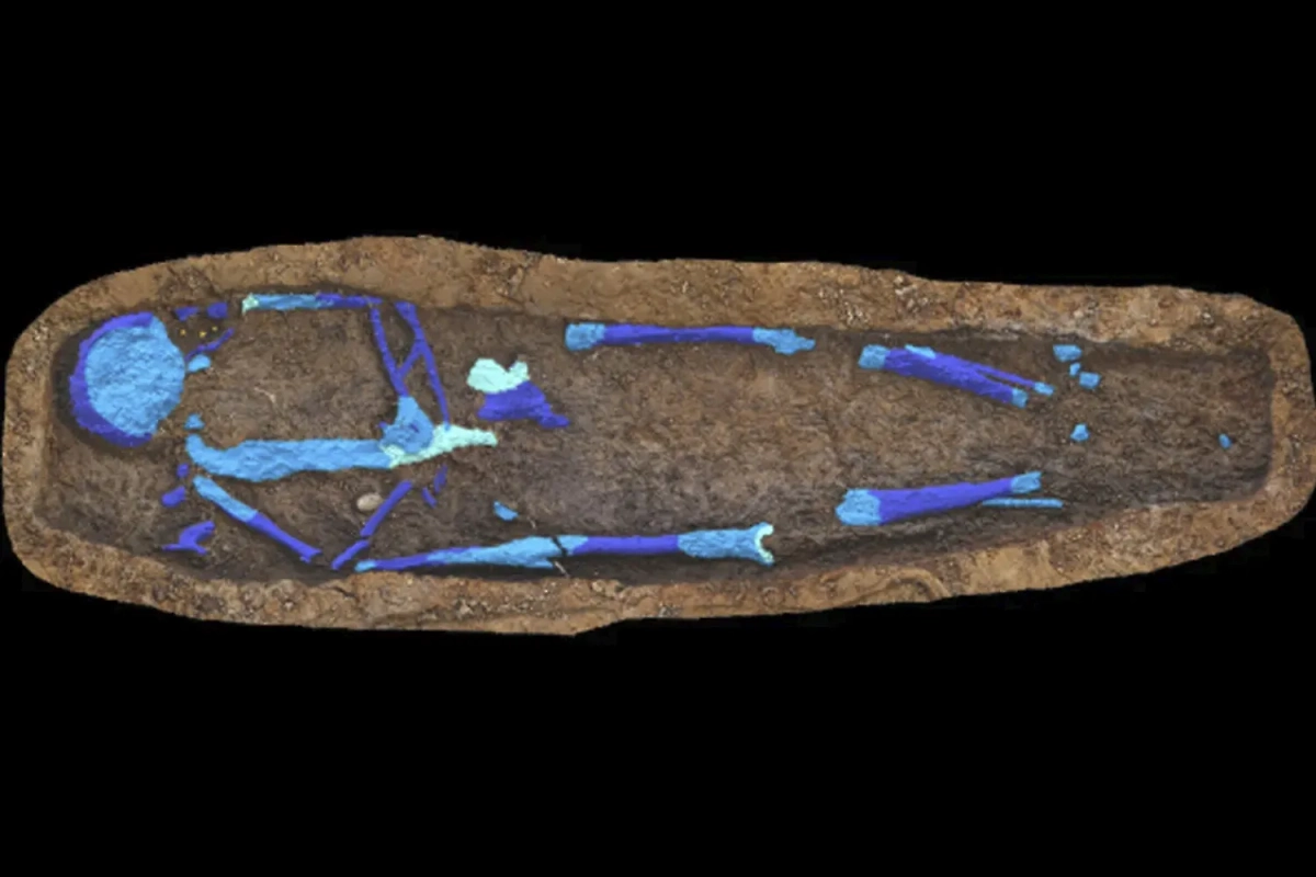 Скелет с "фарфоровым" желчным пузырём, найденный в США. Обложка © Asylum Hill Project, UMMC; Kyle Winters