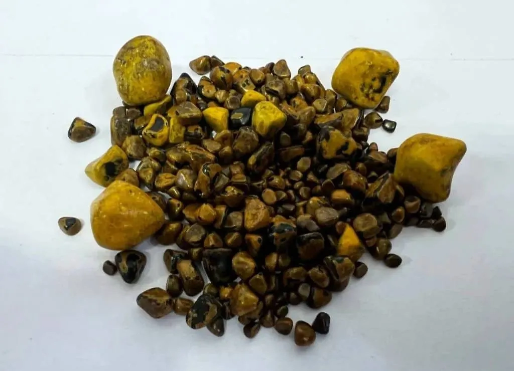 Камни, которые удалили хирурги из желчного пузыря жительницы Коломны. Обложка © Министерство здравоохранения Московской области