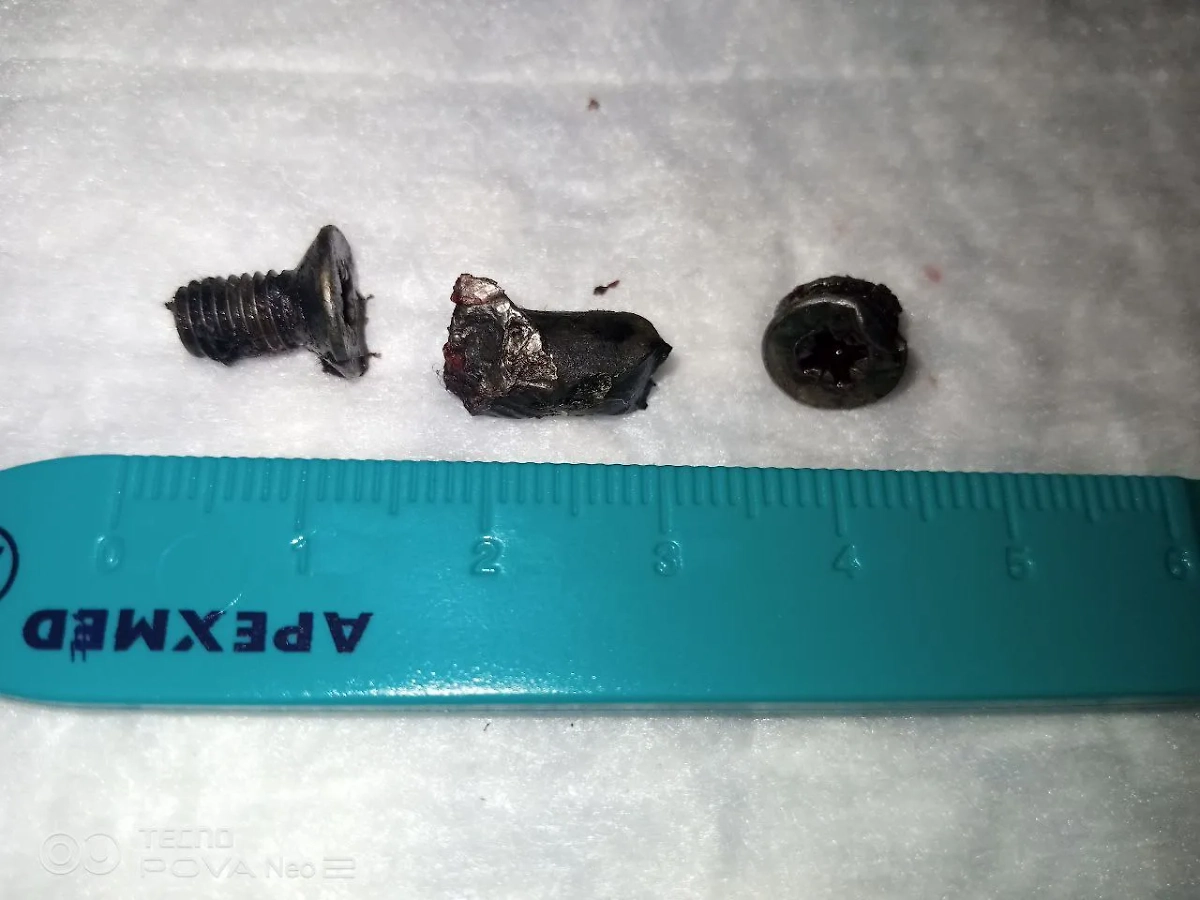 ВСУ стали использовать болты в качестве поражающих элементов. Фото © Telegram /КУЧИЦ Мед . KUCHITS MED