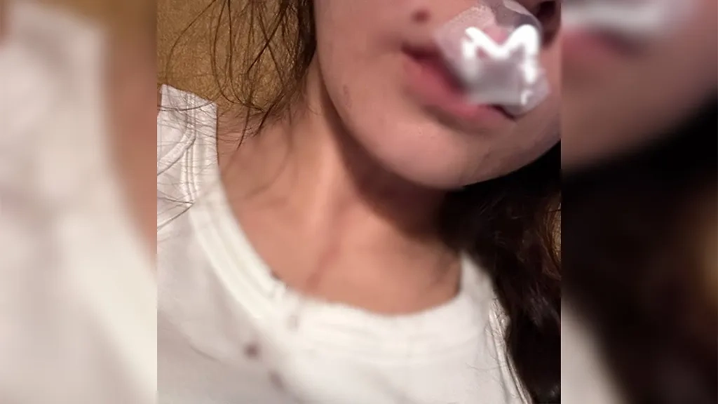 Пострадавшая от нападения обезьяны в Хабаровском крае. Фото © Telegram / Amur Mash