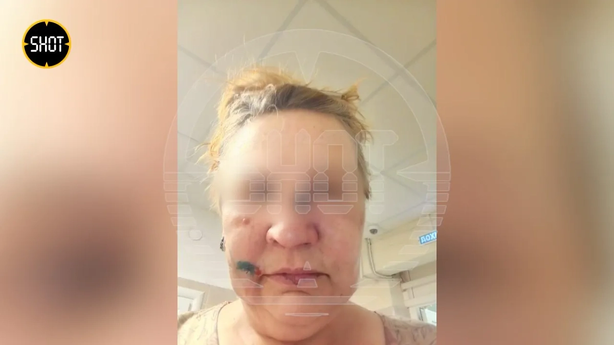 Продавщица, избитая в Курской области. Фото © SHOT