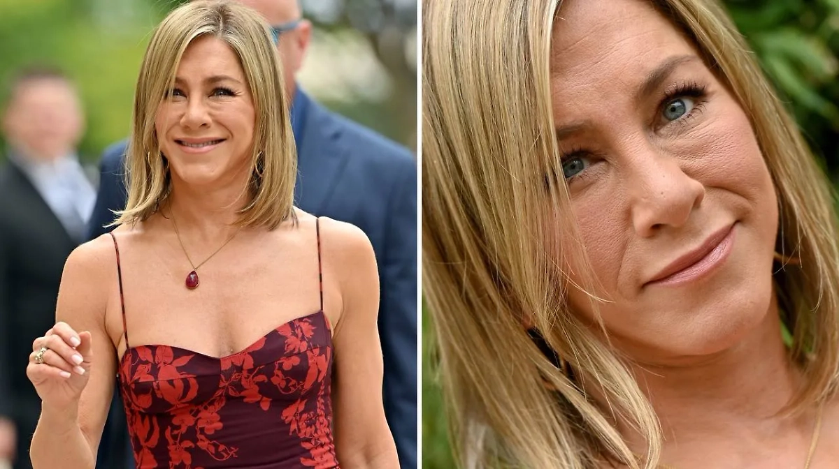 Вот с такими последствиями столкнулась звезда сериала "Друзья" Дженнифер Энистон. Виной всему неправильная работа косметолога или некачественный препарат? Фото © Getty Images / Axelle / Bauer-Griffin