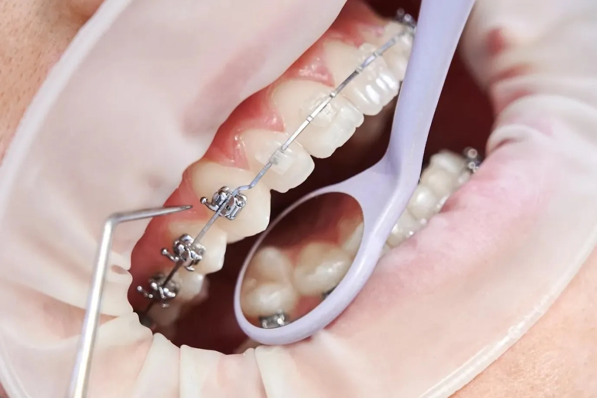 Опасные товары с маркетплейсов: что нельзя покупать. Фото © Freepik / ArtPhoto_studio