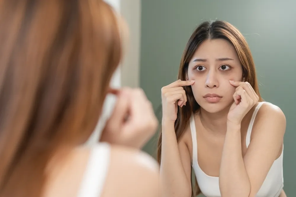 Девушка с "кругами Панды" под глазами. Обложка © Shutterstock / FOTODOM / Pormezz