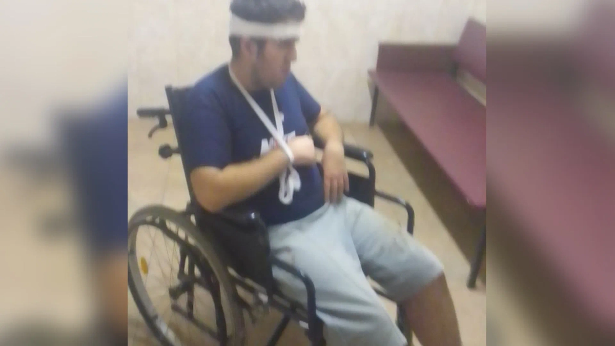 Пострадавший после оказания помощи в больнице. Фото © Интернет-издание Regions.ru.