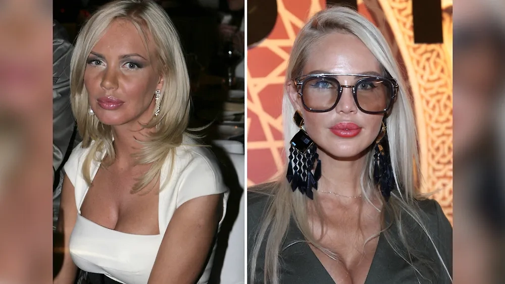 Машу Малиновскую изуродовали во время пластической операции. Фото © ТАСС / Елизавета Клементьева, Сергей Виноградов