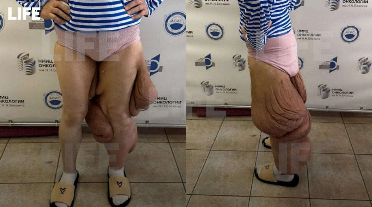 Ирина до операции. Фото © Life.ru