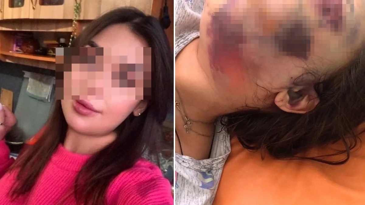 На лице пострадавшей буквально не осталось живого места. Обложка © VK / Подслушано о работе. Троицк