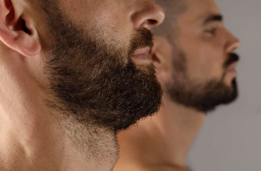 Чтобы не прятать второй подбородок за бородой, нужно вовремя посетить ортодонта. Фото © Freepik