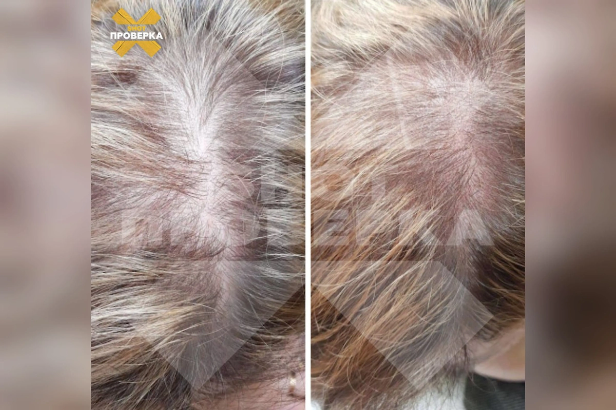 В России женщины начали массового делать трихопигментацию волос. Обложка © Telegram / SHOT ПРОВЕРКА