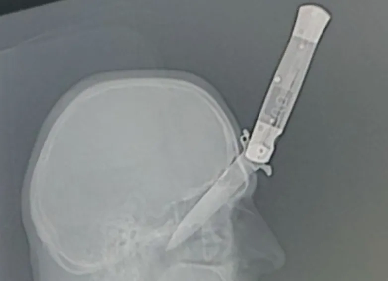 Мужчина на Ставрополье получил ножевое ранение головы. Обложка © Mz26.ru