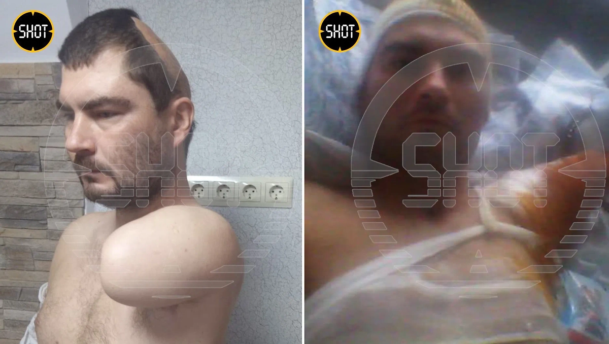 Пострадавший от удара током мужчина. Фото © t.me / SHOT