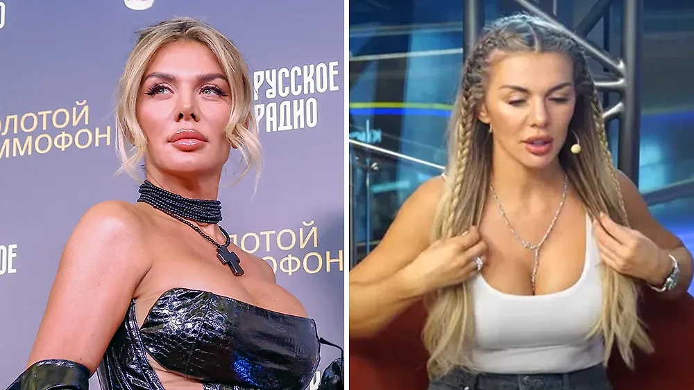 Когда Анна Седокова использует минимум косметики, заметны проблемы с кожей. Фото © ТАСС / Артём Геодакян, © YouTube / Жара TV