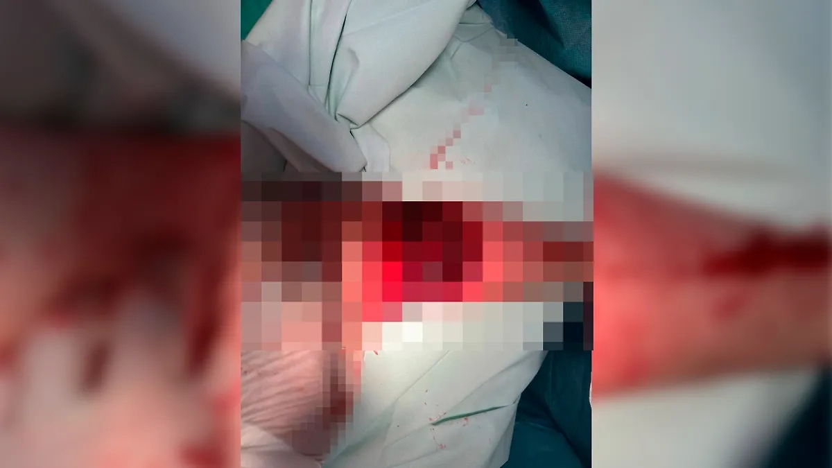 В Ногинске 42-летний мужчина чуть не лишился руки. Фото © Минздрав Подмосковья