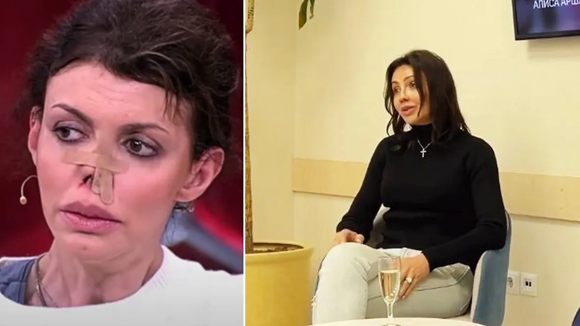 Бывшая жена российского футболиста Андрея Аршавина Алиса Казьмина. Обложка © YouTube / Россия-1, © Instagram (соцсеть запрещена в РФ; принадлежит корпорации Meta, которая признана в РФ экстремистской) / dega_clinic