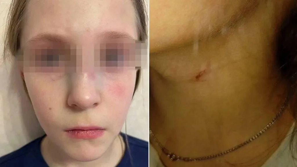 Девочки, которых столкнул головами мужчина в Балабанове Калужской области. Обложка © Telegram / Типичное Балабаново