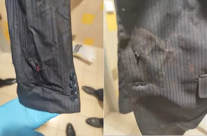 Костюм Фицо после покушения. Фото © X / oskibarami