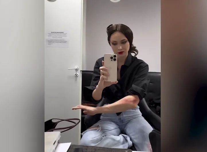 Настасья Самбурская показала рану на руке после ДТП с мопедом в Москве. Обложка © Instagram (признан экстремистской организацией и запрещён на территории Российской Федерации) / samburskaya