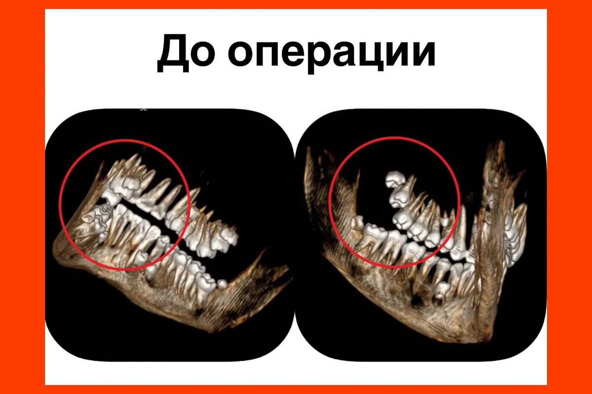 Врачи удалили 14 лишних зубов у подростка. Фото © Telegram / Детский центр им. Рошаля
