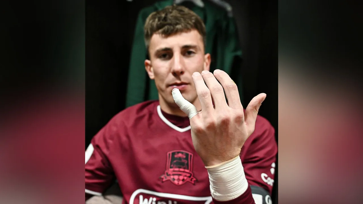 Вратарь «Краснодара» Станислав Агкацев со сломанным пальцем после матча с махачкалинским «Динамо». Фото © Telegram / ФК «Краснодар»