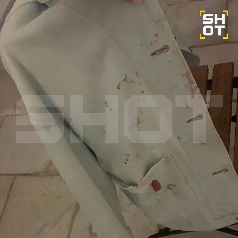 Следы от побоев. Фото © Telegram / SHOT