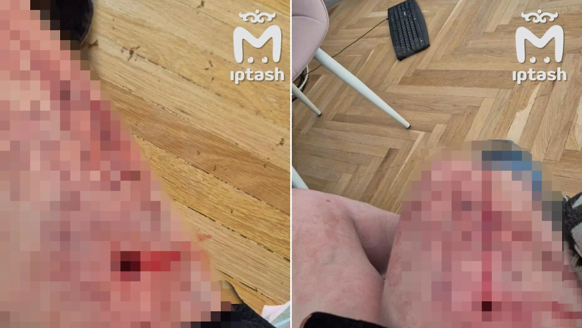 Мужчина выстрелил в бедро своей девушке за игнорирование оскорблений. Фото © Telegram / Mash Iptash