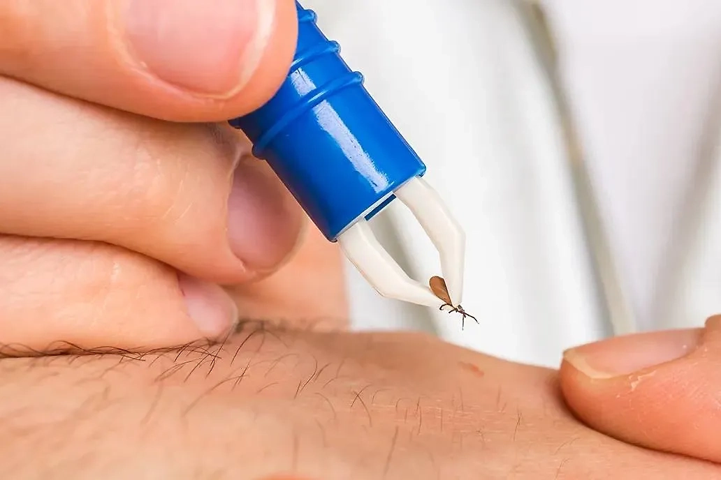 Клеща извлекают пинцетом или нитью. Фото © Shutterstock / FOTODOM / andriano.cz