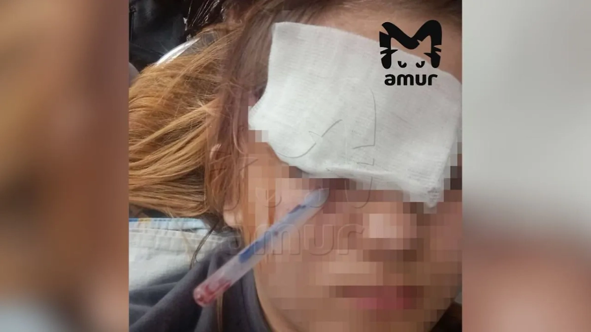 Школьник из Приморья воткнул однокласснице ручку в глаз из-за подзатыльника. Обложка © Telegram / Amur Mash