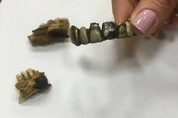 Фрагменты челюсти Гитлера. Фото © Telegram / «МеркачёваПрава»