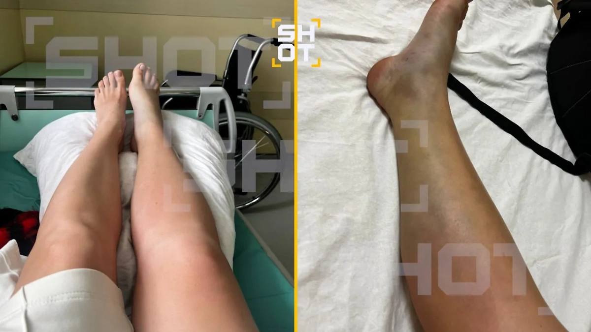 Змеи активно нападают на российских туристов на Бали. Фото © SHOT