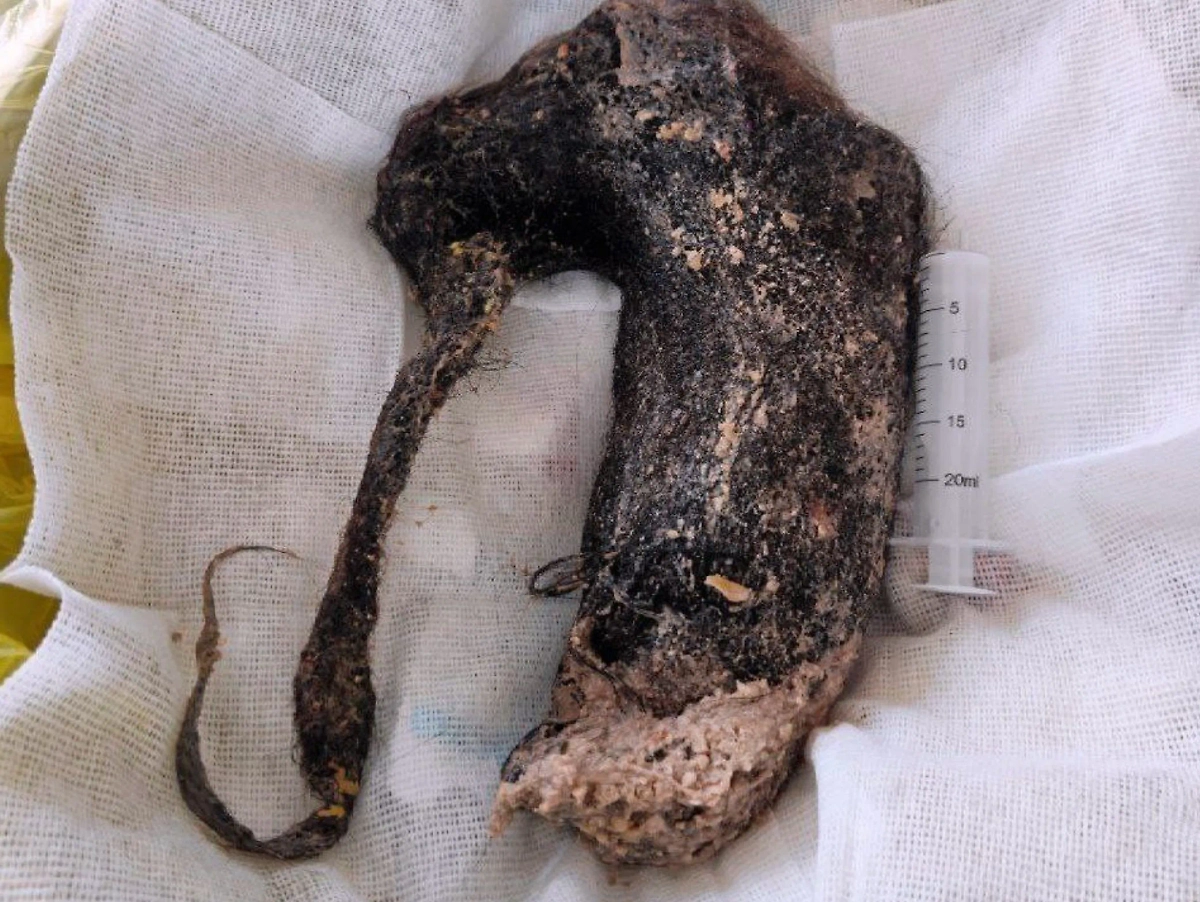 Ком из волос, который достали из желудка девочки в Нижнем Новгороде. Обложка © НОДКБ