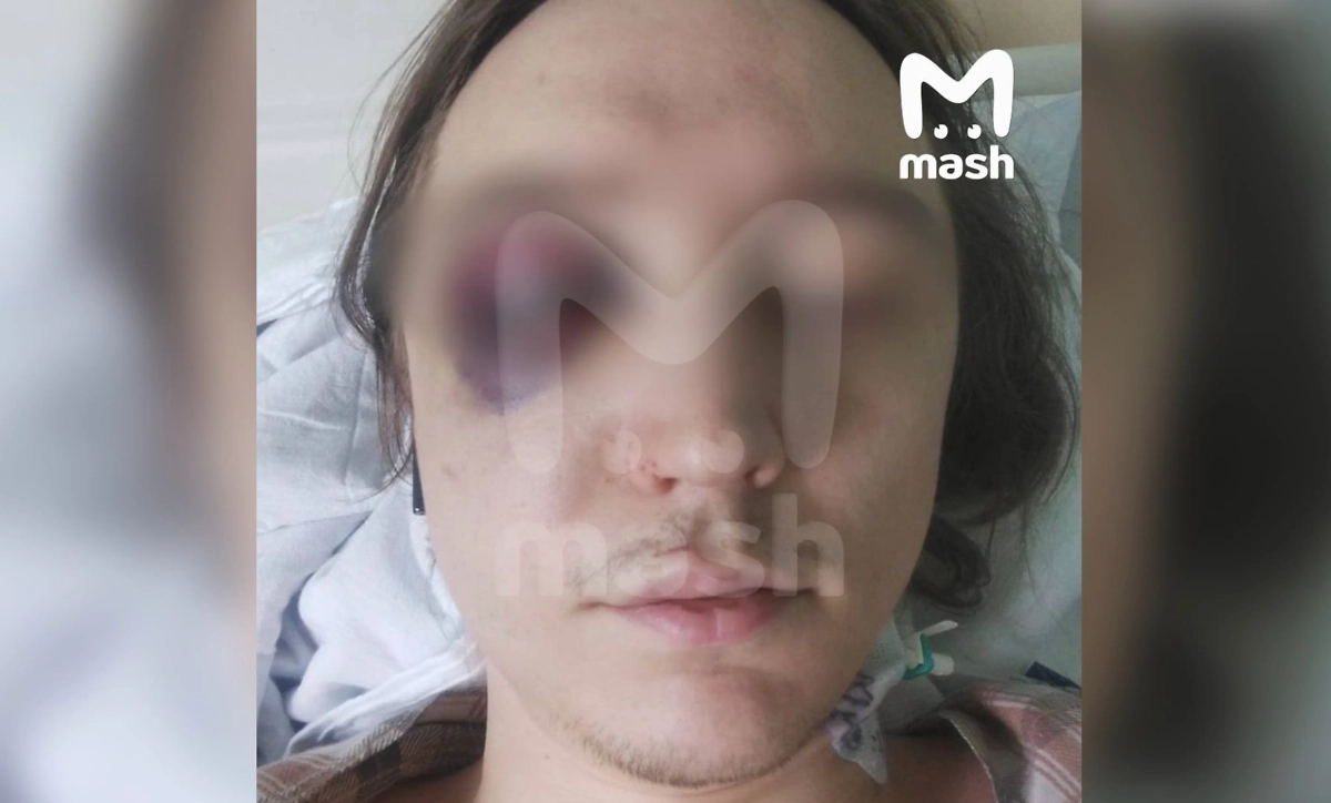 Школу моделей «Лидер» в Москве заподозрили в избиении клиента. Фото © Telegram / Mash