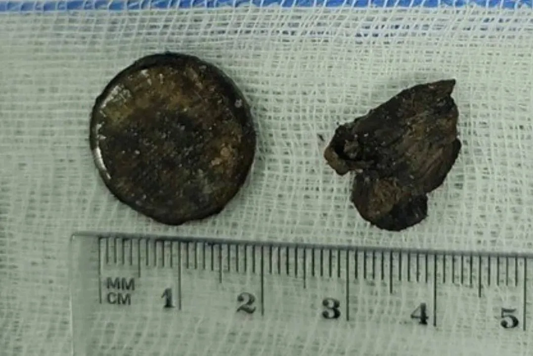 Обложка © Предоставлено Life.ru ДГКБ им З.А. Башляевой