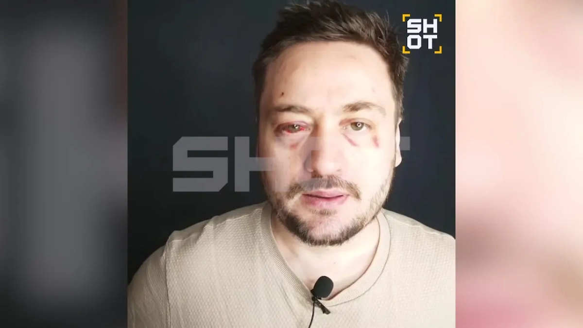 Актёра из «Беспринципных» и «Слепой» Руслана Алдонина избили возле бара в центре Москвы. Фото © SHOT