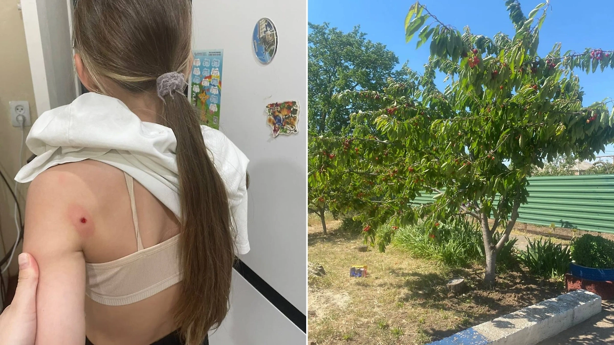 Пострадавшая девочка и та самая черешня, из-за которой произошёл скандал. Обложка © Telegram / Наша неделя. Пролетарск