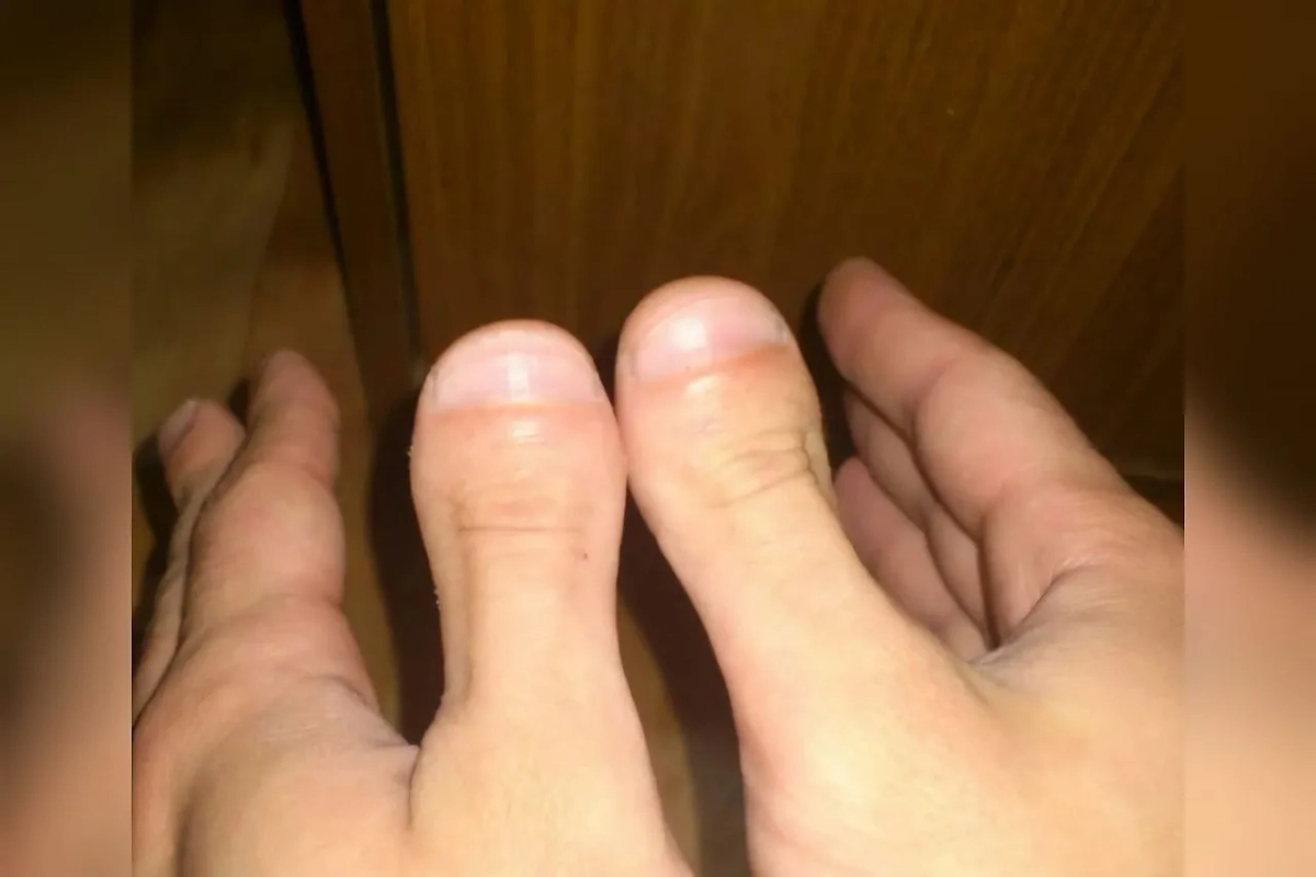 Как выглядит «палец убийцы», или «палец палача». Фото © Instagram (признан экстремистской организацией и запрещён на территории Российской Федерации) / 3dhiroschool