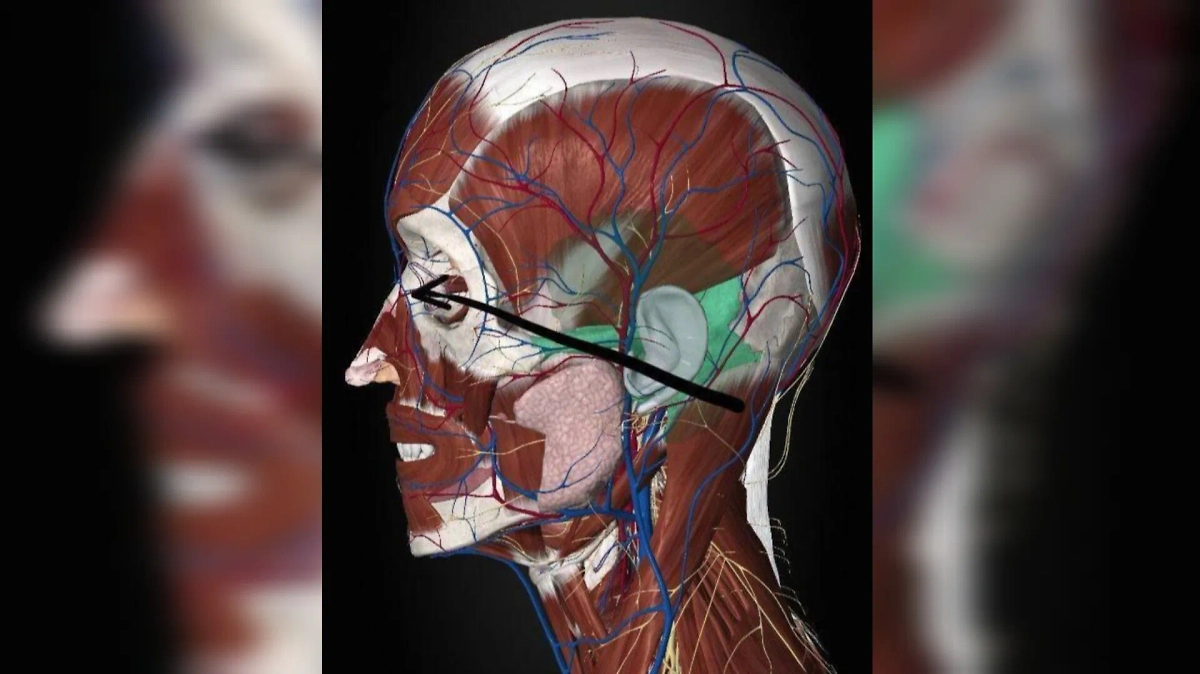 Траектория прохождения пули. Фото © Telegram / Mash на Донбассе