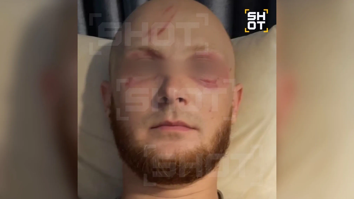 Самая опасная медуза в мире сожгла веки россиянину во Вьетнаме. Фото © SHOT