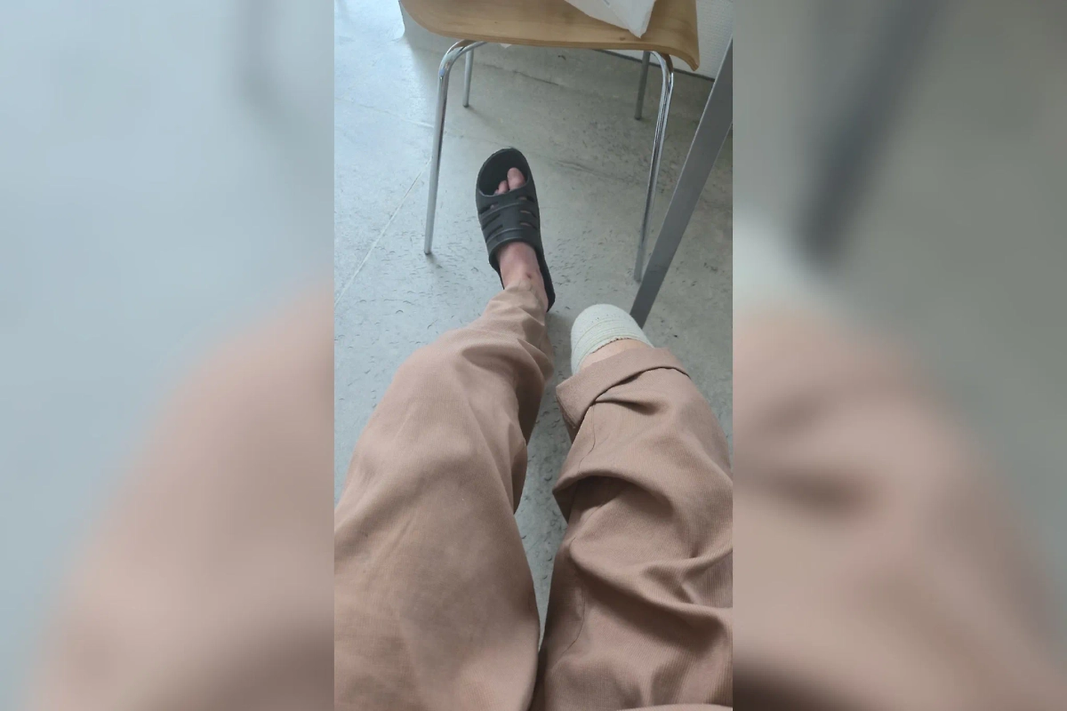 Участник СВО после ампутации. Фото © VK / pso_pnv