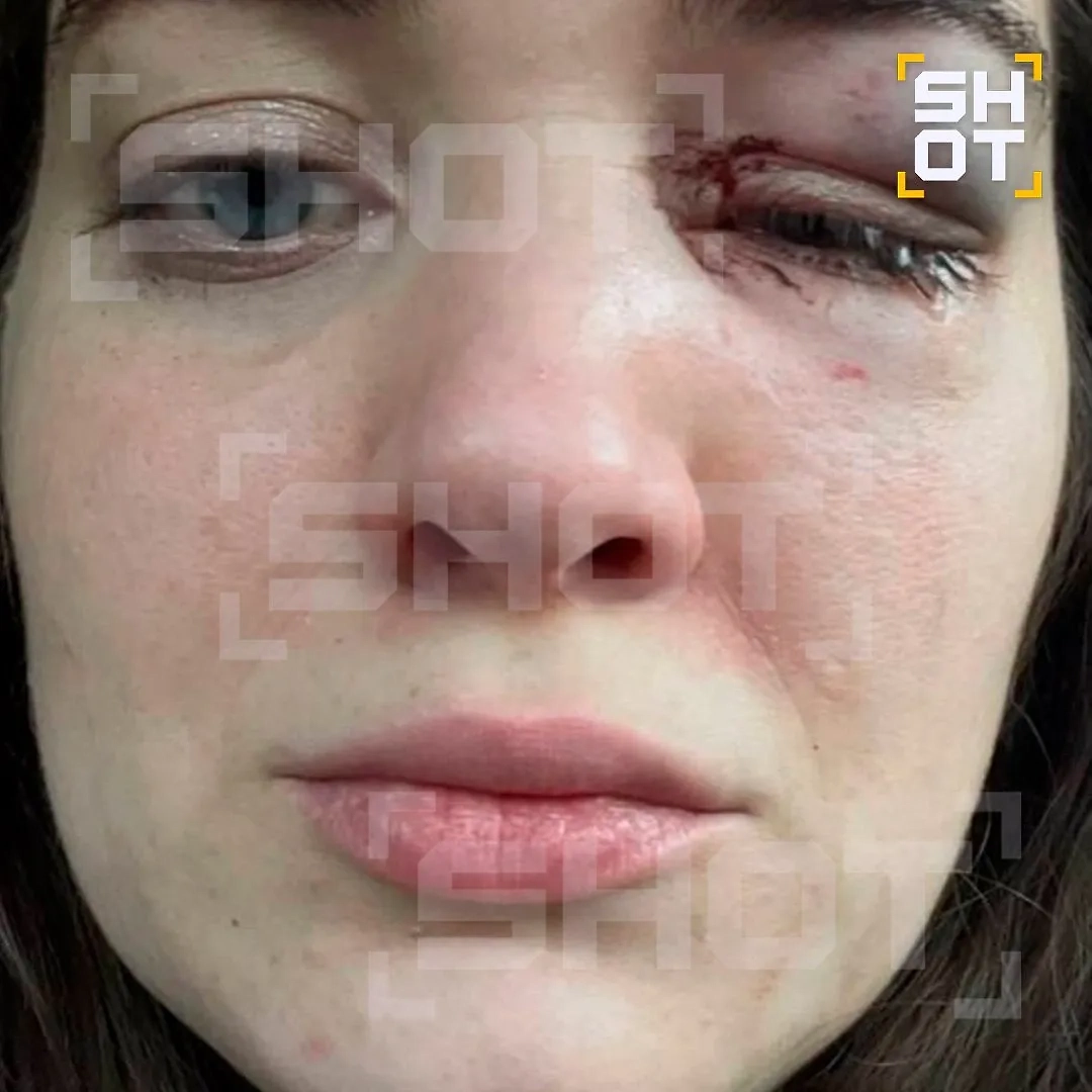 Последствия удара Гончарова. Фото © SHOT