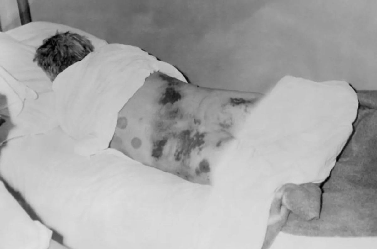 Казалось бы, где Конго и где Крым? В названии этой лихорадки они близки как никогда. Фото © Wikipedia / CDC/Dr. B.E. Henderson