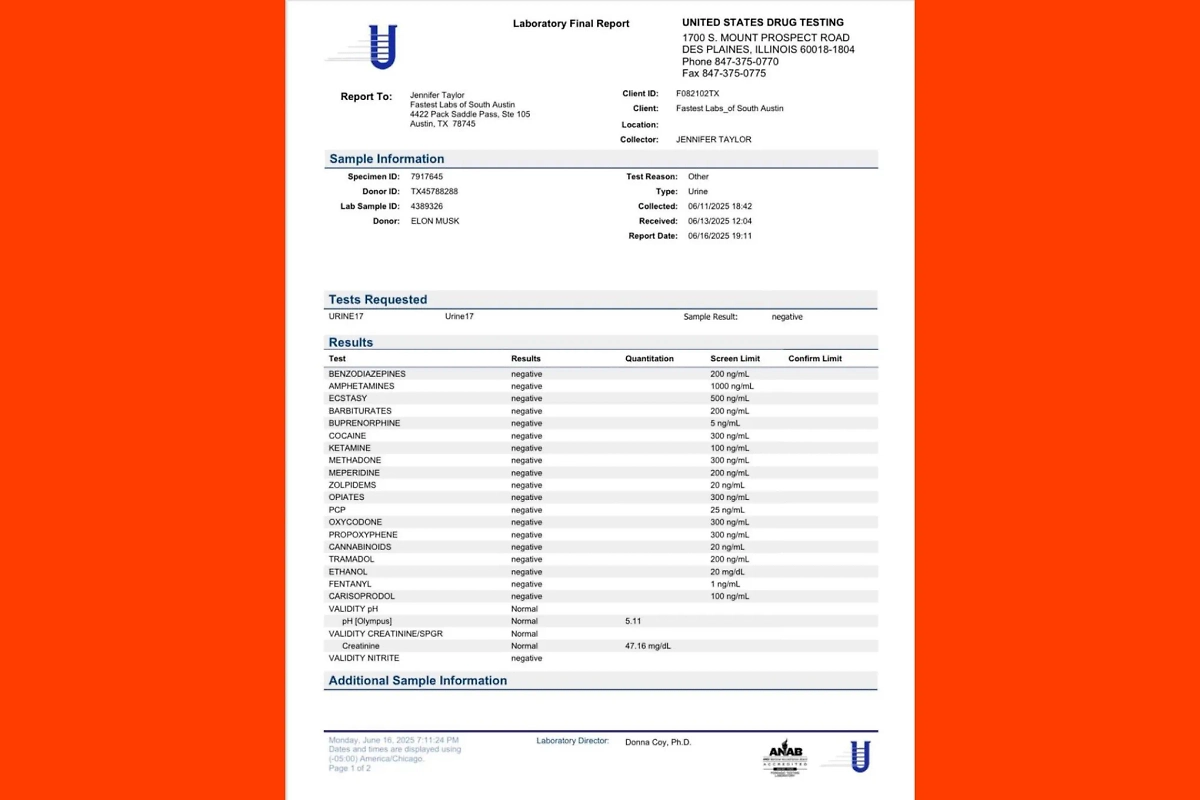 Отрицательные результаты Маска после теста на запрещённые вещества. Фото © Х /  elonmusk