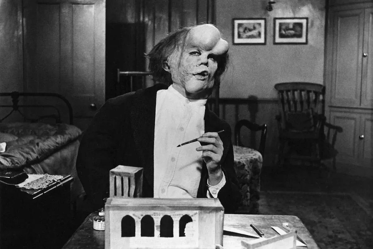 Фото © Кадр из фильма «Человек-слон», режиссёр Дэвид Линч, сценаристы Кристофер Де Вор, Эрик Бергрен, Дэвид Линч и др. / Kinopoisk