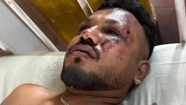 Гражданин Британии выжил в катастрофе. Фото © Х / nitinmeshram_