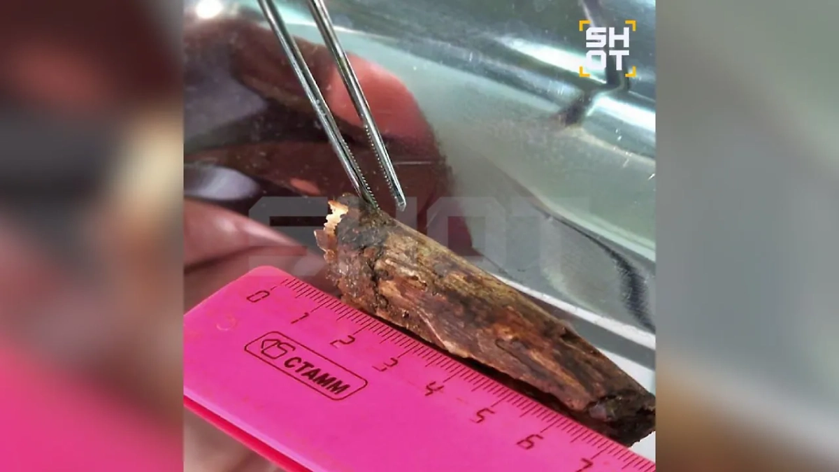 Рыбак упал на сук и чуть не лишился зрения. Фото © Telegram/ SHOT