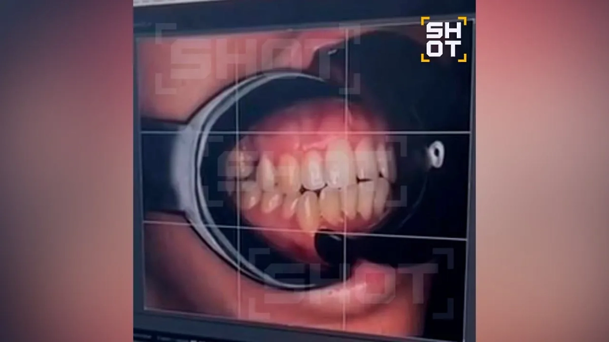 Зубы пациентки. Фото © Telegram / SHOT