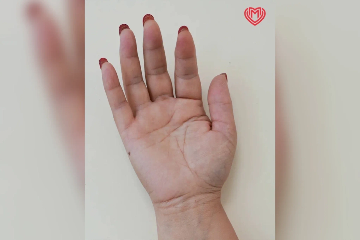 Московские врачи спасли жительницу столицы после укуса скорпиона. Фото © Московский департамент здравоохранения