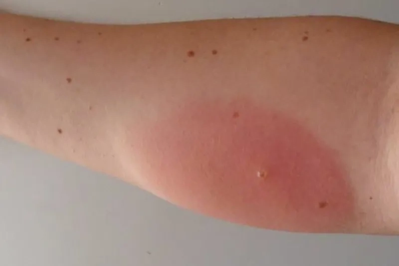 Звёздочка вечера — бычий овод. От чистого сердца желаем вам никогда с ним не встречаться. Фото © kenellya