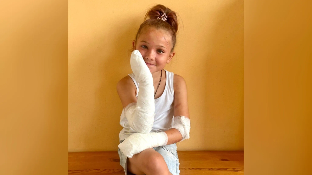 В Подмосковье 10-летняя девочка пострадала, получив сильные ожоги от борщевика. Обложка © Telegram / ГБУЗ МО «МОЦОМД»